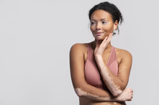 The Best Sleepwear for Sensitive Skin: A Guide for Eczema, Allergies, and Easily-Irritated Skin